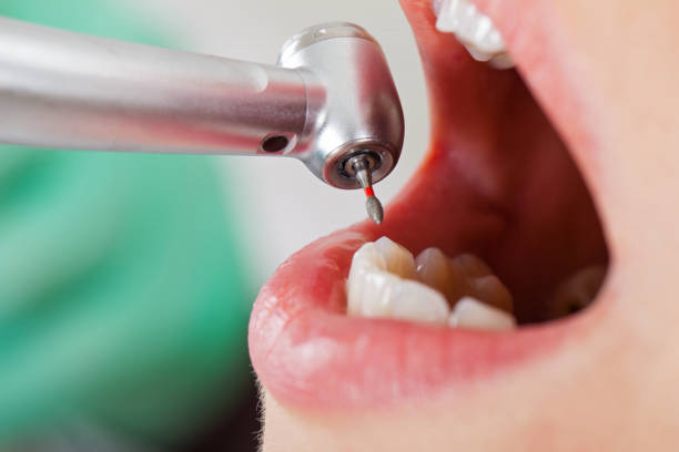 Best Emergency Denture Repair in Forest City, IA